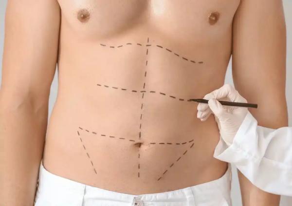 وقتی بیماران به مدل پیکرتراشی تبدیل می شوند، اقتصاد پنهان عکس های قبل و بعد پیکرتراشی وقتی بیماران به مدل پیکرتراشی تبدیل می شوند، اقتصاد پنهان عکس های قبل و بعد پیکرتراشی